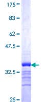 Human SLC18A3 / VACHT Protein (Recombinant GST, N-terminus)