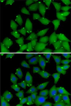 RBBP7 / RbAp46 Antibody
