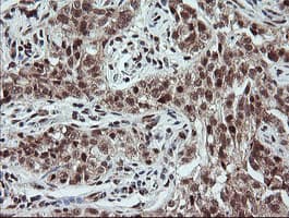 MME / CD10 Antibody (clone OTI3D11)