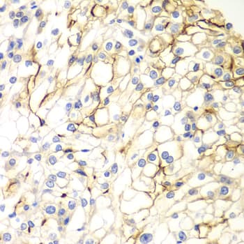 VANGL2 / LTAP Antibody