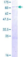 Human RUFY1 Protein (Recombinant GST)