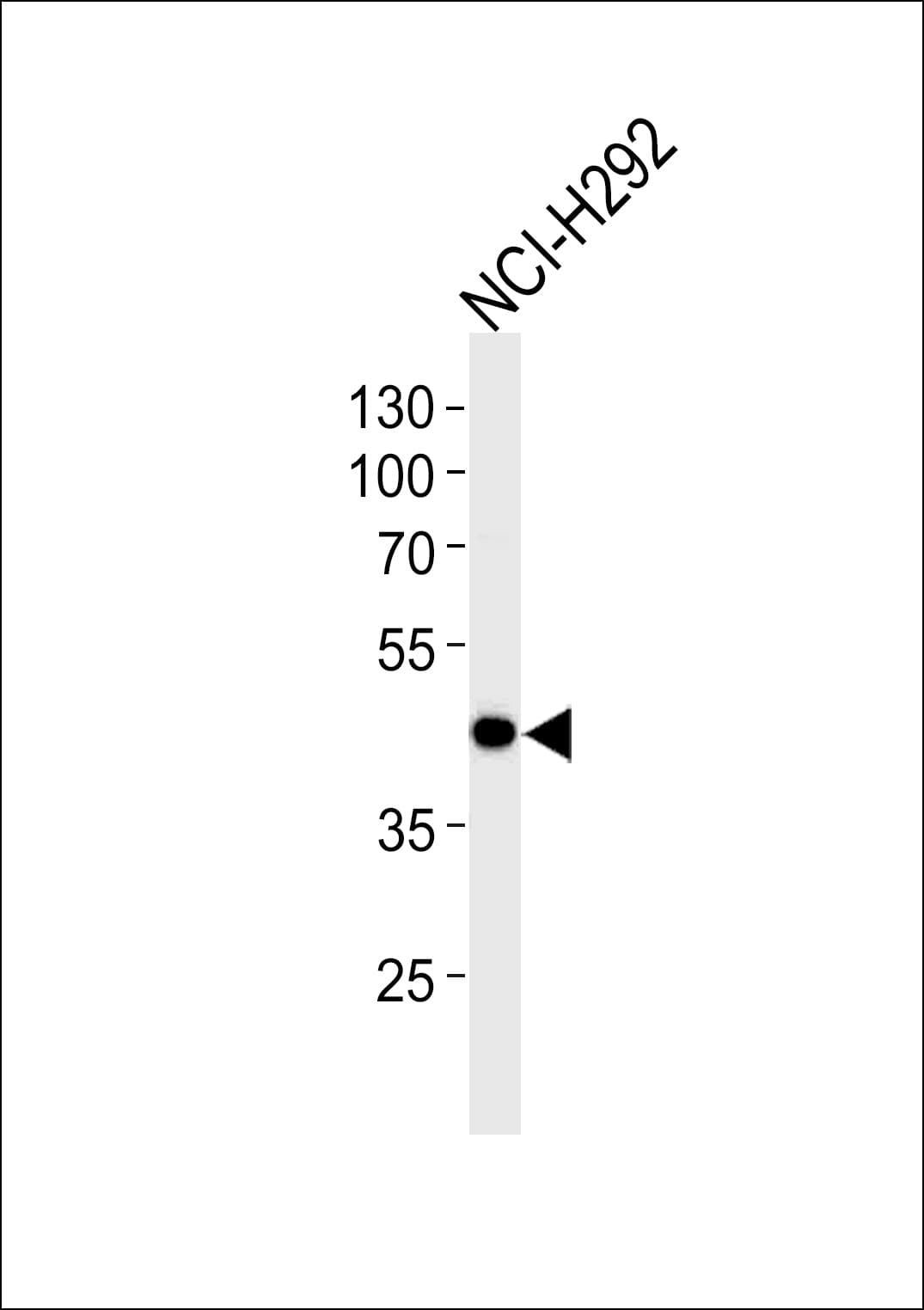 AIM2 Antibody (clone 812CT9.2.2.1)