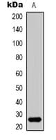 Polyclonal Rabbit anti-Human HMG1 / HMGB1 Antibody (N-Terminus, IHC, WB)