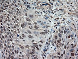Monoclonal Mouse anti-Human NTF3 / Neurotrophin 3 Antibody (clone OTI5A2, IHC, IF, WB)