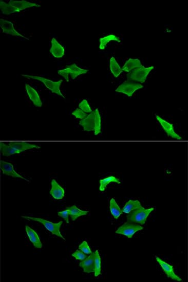 LCP1 / L-Plastin Antibody
