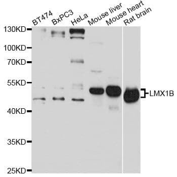 LMX1B Antibody
