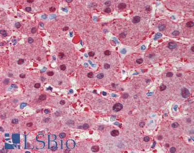 IHC-plus™ ARG1 / Arginase 1 Antibody