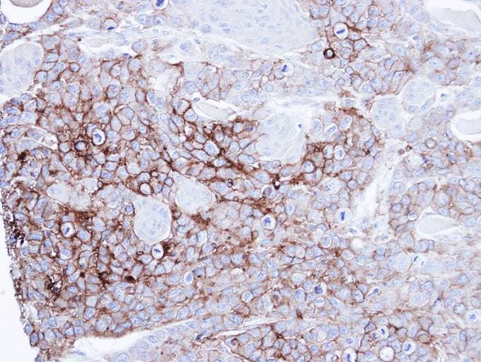 ALPI / Alkaline Phosphatase Antibody (aa3-206)