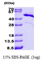 Human TNNT2 / CTNT Protein (Recombinant His)