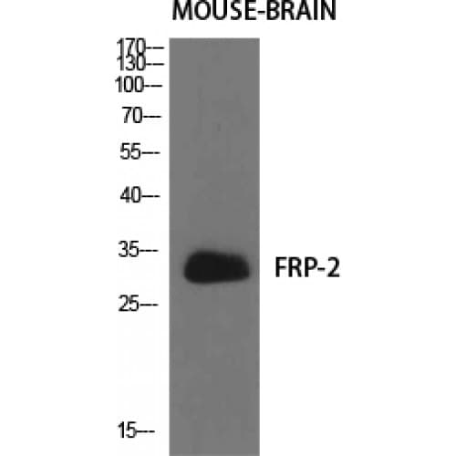 SFRP2 Antibody (90-170 aa, Internal)