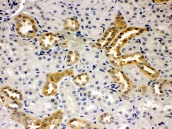 PSEN2 / Presenilin 2 Antibody (aa39-51)