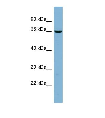 TMCC2 Antibody (aa171-220)