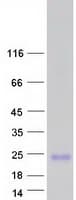 Human SPRR2B Protein (Recombinant Myc-DDK (Flag))