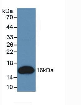 Human TNFRSF9 / 4-1BB / CD137 Protein (Recombinant His, N-Terminal)