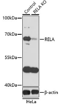 RELA / NFKB p65 Antibody