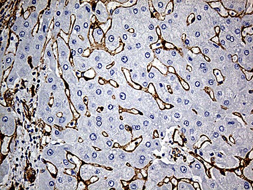 Monoclonal Mouse anti-Human CAV1 / Caveolin 1 Antibody (clone OTI2C4, aa2-104, IHC, WB)