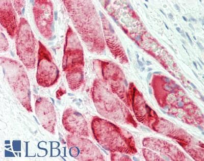 IHC-plus™ Polyclonal Rabbit anti-Human PLA2G3 Antibody (Internal, IHC, WB)