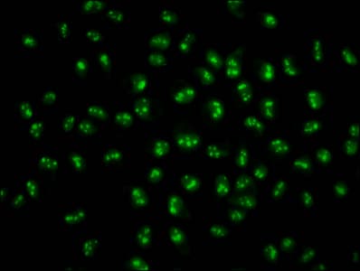 HIST1H2BN Antibody