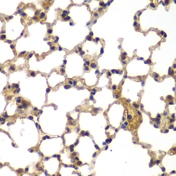 UBXD9 / ASPL Antibody (aa284-553)