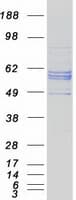 Human CYP27 / CYP27A1 Protein (Recombinant Myc-DDK (Flag))