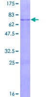 Human SUV39H2 Protein (Recombinant GST)