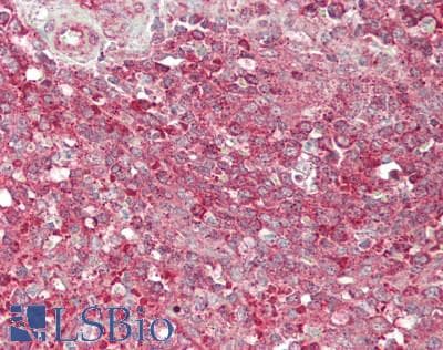 IHC-plus™ DOCK180 / DOCK1 Antibody (aa1815-1865)