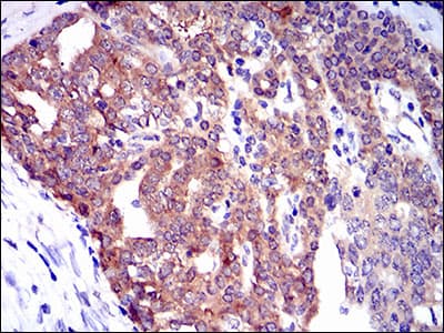 TWF1 / PTK9 Antibody (clone 7C11)