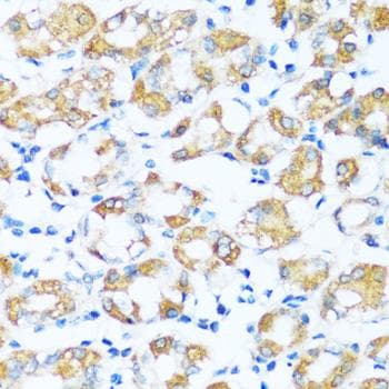 Polyclonal Rabbit anti-Human ARHGEF5 Antibody (IHC)