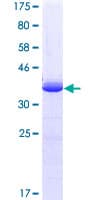 Human HOXC10 Protein (Recombinant GST, N-terminus)