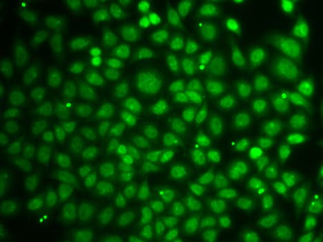 ZNF346 Antibody