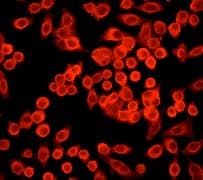 IHC-plus™ ADD1 / Adducin Alpha Antibody (C-Terminus, clone EP734Y)