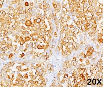 MLANA / Melan-A Antibody (clone M2-9E3, Azide-free, BSA-free)