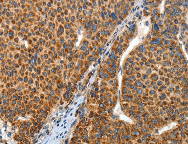 Polyclonal Rabbit anti-Human ANGPTL1 Antibody (IHC)