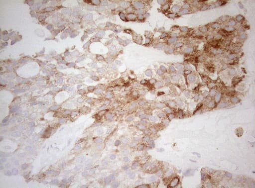 DECR1 Antibody (clone OTI8F11)