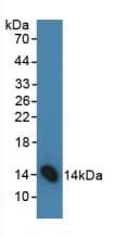 FSHB / FSH Beta Antibody (aa21-130, PE)