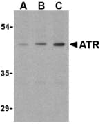 ANTXR1 / TEM8 Antibody