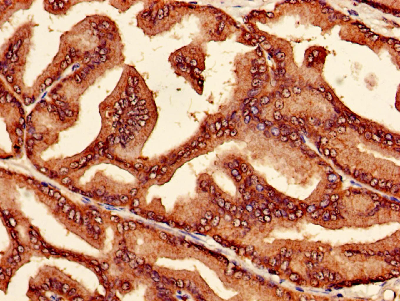 PSMB7 Antibody