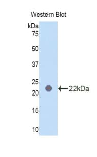 PRDX2 / Peroxiredoxin 2 Antibody (aa6-164)