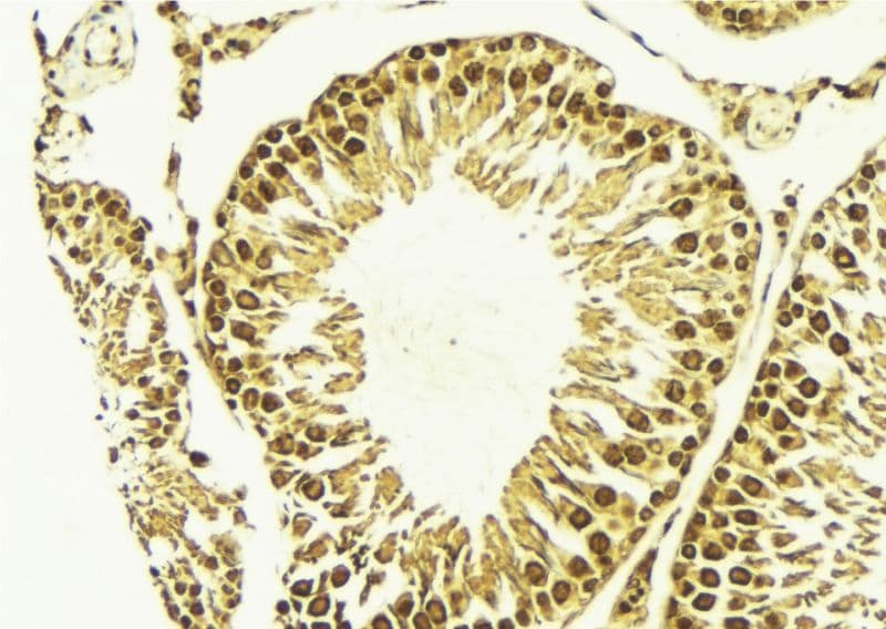 IKBKB / IKK2 / IKK Beta Antibody