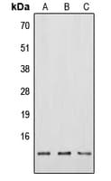 NMB / Neuromedin B Antibody (N-Terminus)