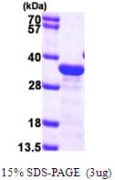 Human MAPRE1 / EB1 Protein (Recombinant His)