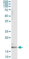IHC-plus™ Monoclonal Mouse anti-Human CYB5A / Cytochrome b5 Antibody (clone 1A8, IHC, WB)