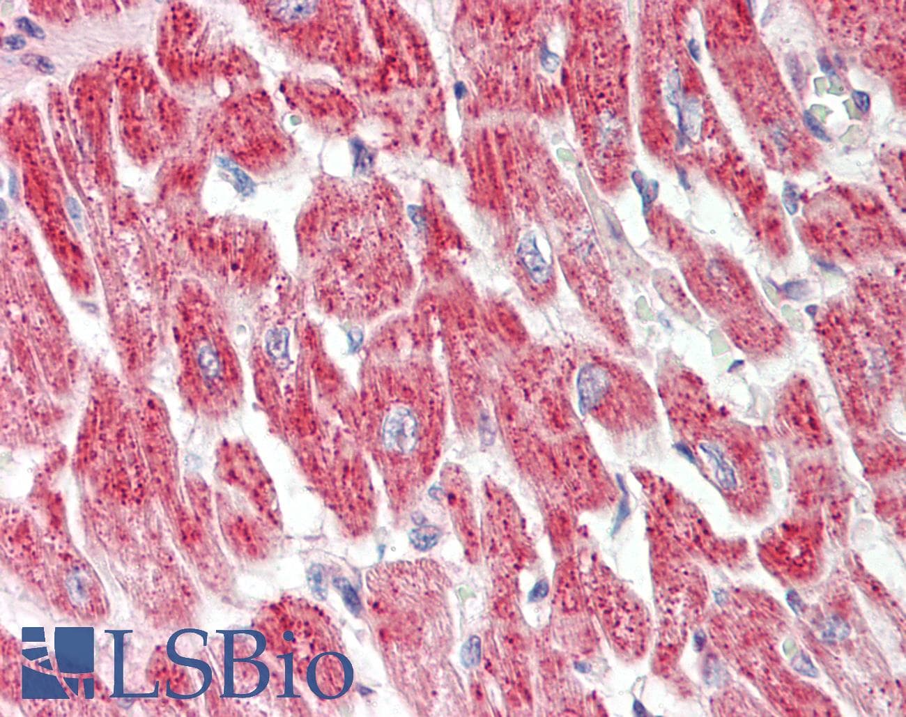 RRAD Antibody (aa107-156)