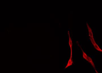 ARG1 / Arginase 1 Antibody