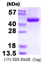 Human ACADSB Protein (Recombinant His)