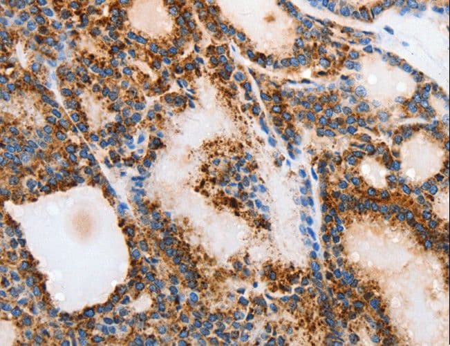 Polyclonal Rabbit anti-Human MUC6 / MUC-6 Antibody (IHC)