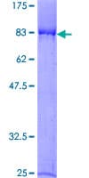 Human G3BP2 Protein (Recombinant GST)
