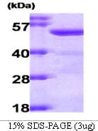 Human ALDH2 Protein (Recombinant)