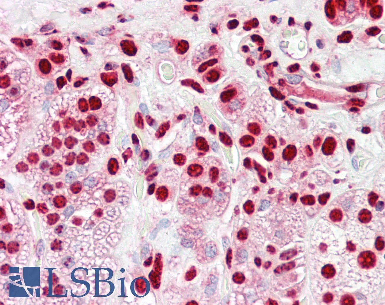 PathPlus™ HNRNPK / hnRNP K Antibody (aa1-50)