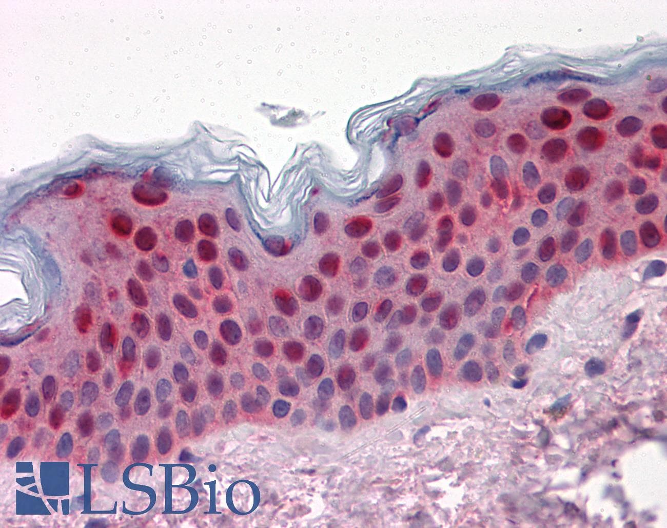 IHC-plus™ Monoclonal Mouse anti-Human SFN / Stratifin / 14-3-3 Sigma Antibody (clone 3C3, IHC, WB)